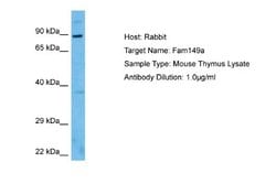 FAM149A Rabbit anti-Mouse, Polyclonal, Novus Biologicals 0.1 mL | Buy Online | Novus Biologicals | Fisher Scientific